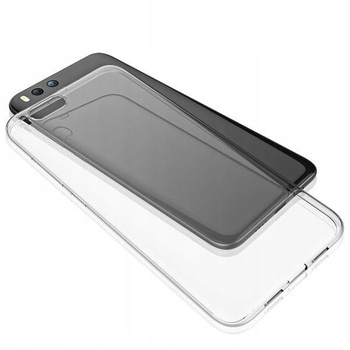 Ultra Slim 0.3mm Overlay - Xiaomi Mi 6
